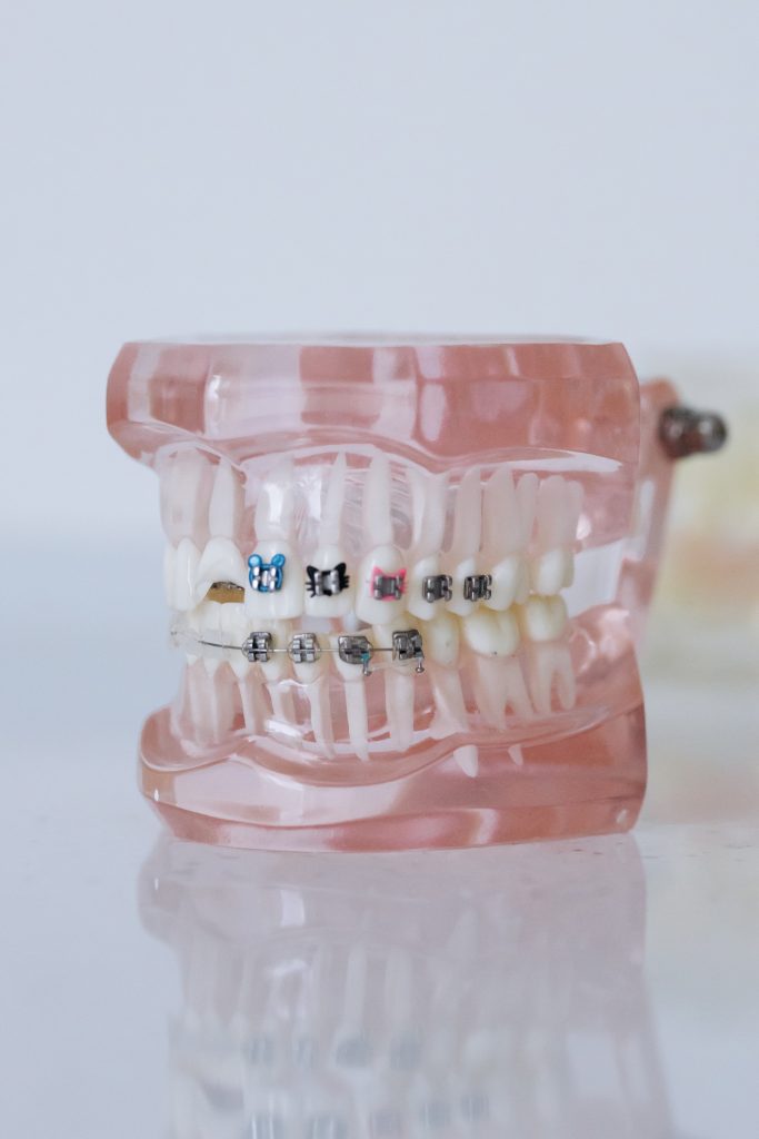 Dental prothesis shown